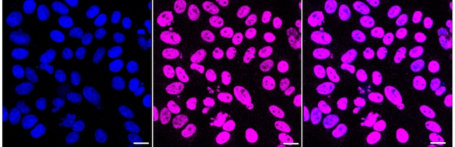 JunB Antibody in Immunocytochemistry (ICC/IF)