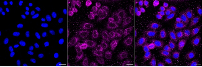 IRAK1 Antibody in Immunocytochemistry (ICC/IF)