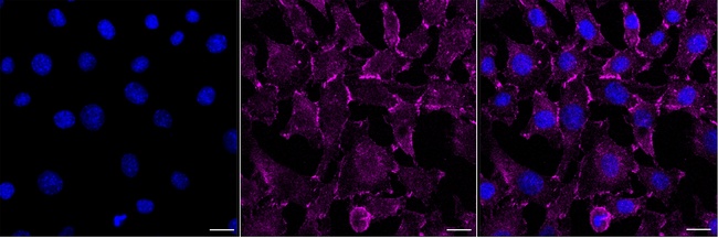 IQGAP1 Antibody in Immunocytochemistry (ICC/IF)