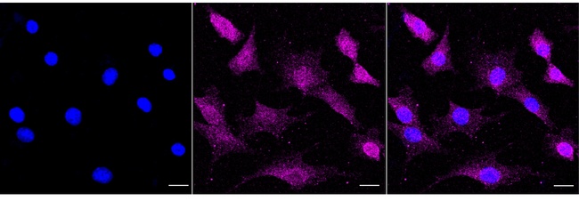 ILK Antibody in Immunocytochemistry (ICC/IF)