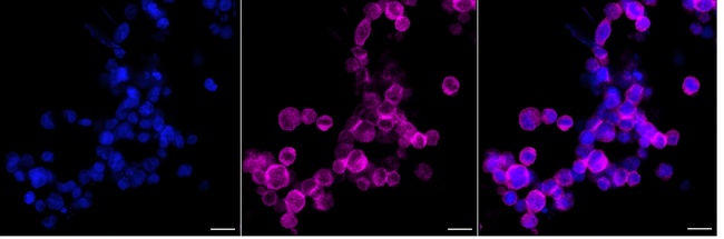 IkB epsilon Antibody in Immunocytochemistry (ICC/IF)