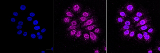 IkB alpha Antibody in Immunocytochemistry (ICC/IF)