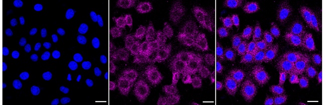 IGF2BP3 Antibody in Immunocytochemistry (ICC/IF)