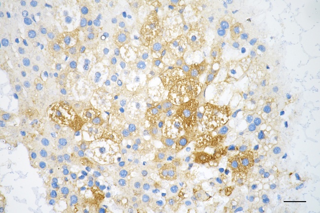 IGF2BP2 Antibody in Immunohistochemistry (Paraffin) (IHC (P))