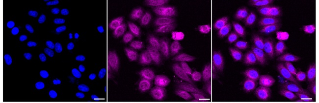 Huntingtin Antibody in Immunocytochemistry (ICC/IF)