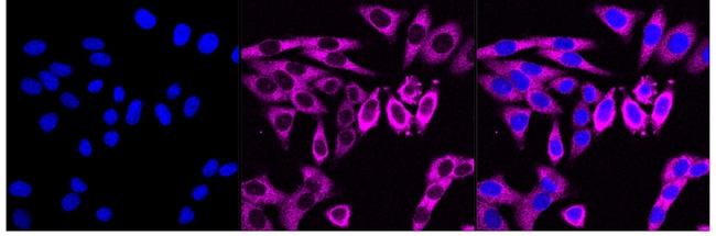 PKR Antibody in Immunocytochemistry (ICC/IF)