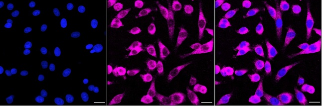 PKR Antibody in Immunocytochemistry (ICC/IF)