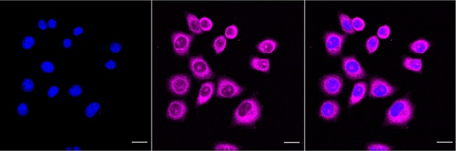 PKR Antibody in Immunocytochemistry (ICC/IF)