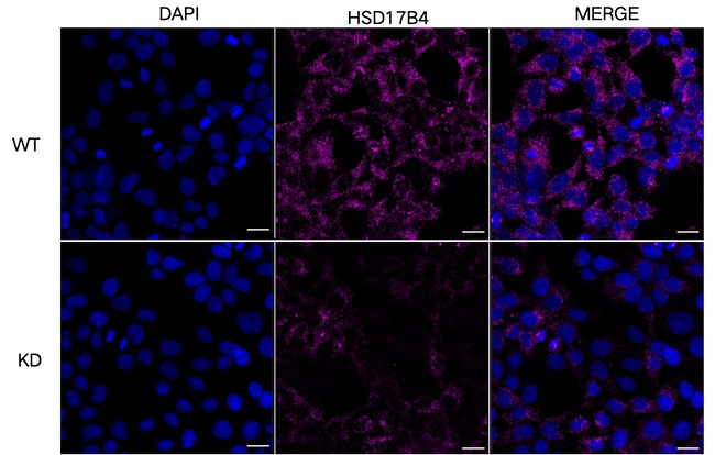 HSD17B4 Antibody in Immunocytochemistry (ICC/IF)