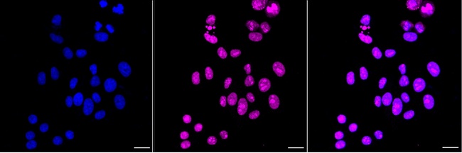 HNRNPA0 Antibody in Immunocytochemistry (ICC/IF)
