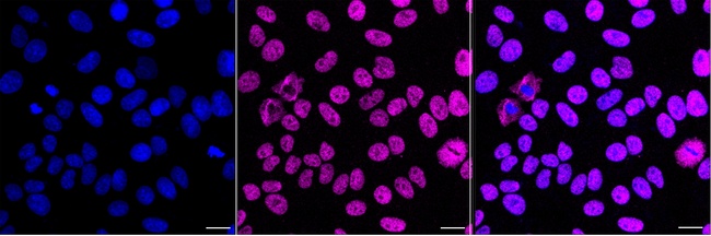 hnRNP A1L2 Antibody in Immunocytochemistry (ICC/IF)