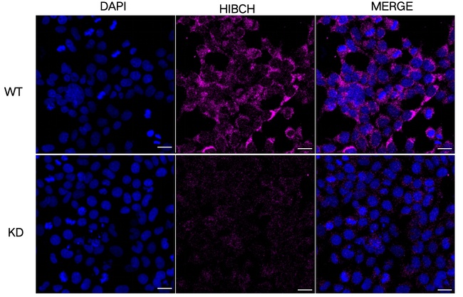 HIBCH Antibody in Immunocytochemistry (ICC/IF)