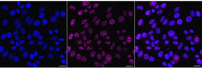 HEXIM1 Antibody in Immunocytochemistry (ICC/IF)