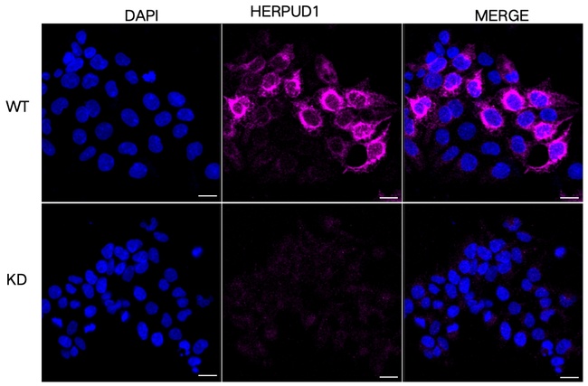 HERPUD1 Antibody in Immunocytochemistry (ICC/IF)