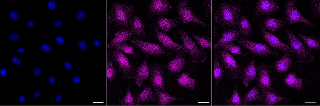 HDHD2 Antibody in Immunocytochemistry (ICC/IF)