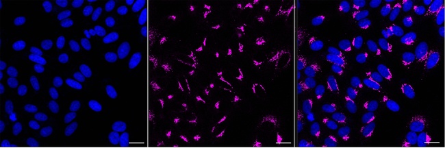 GOLPH2 Antibody in Immunocytochemistry (ICC/IF)