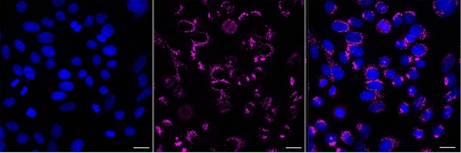 GOLPH2 Antibody in Immunocytochemistry (ICC/IF)