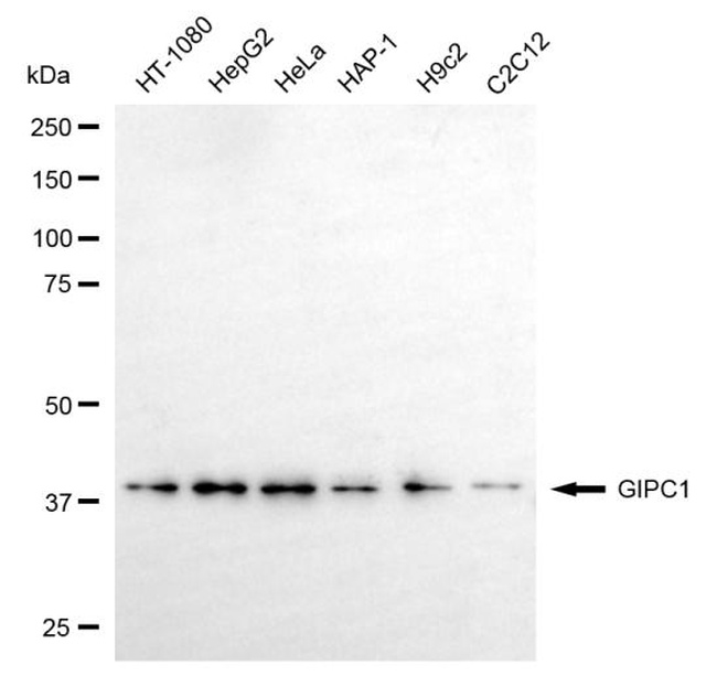 GIPC1 Antibody in Western Blot (WB)