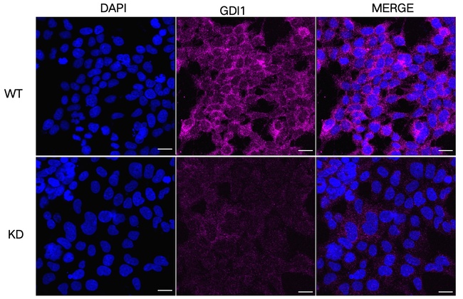 GDI1 Antibody in Immunocytochemistry (ICC/IF)