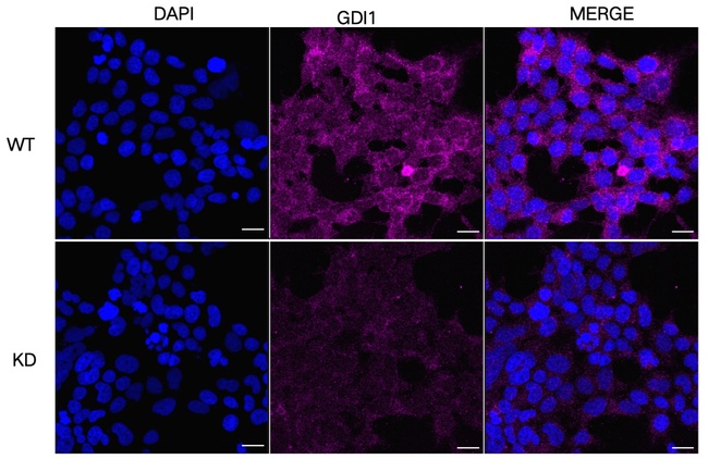 GDI1 Antibody in Immunocytochemistry (ICC/IF)