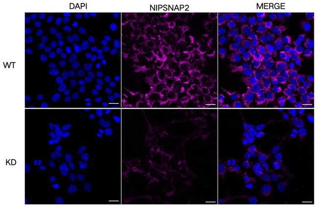 GBAS Antibody in Immunocytochemistry (ICC/IF)