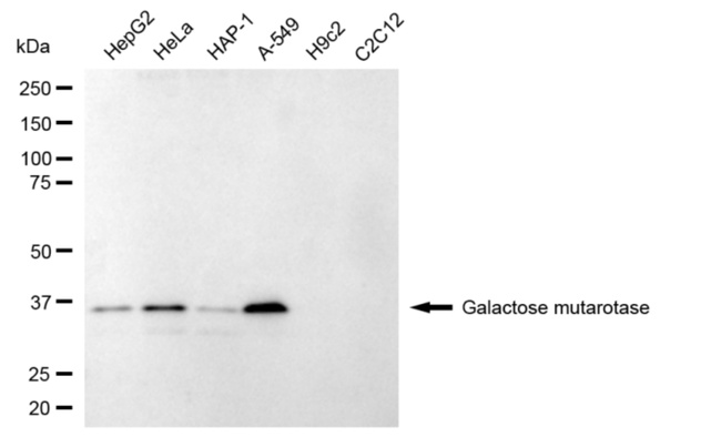 GALM Antibody in Western Blot (WB)