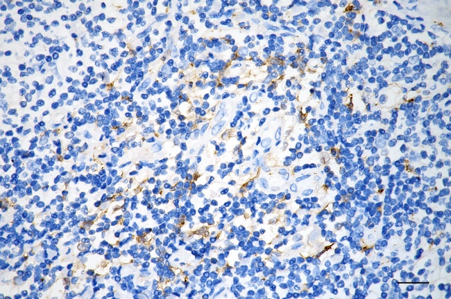 GAA Antibody in Immunohistochemistry (Paraffin) (IHC (P))