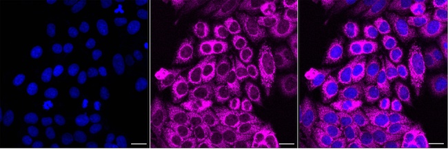 Fumarase Antibody in Immunocytochemistry (ICC/IF)