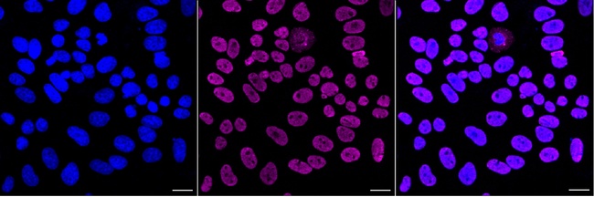 FUBP1 Antibody in Immunocytochemistry (ICC/IF)