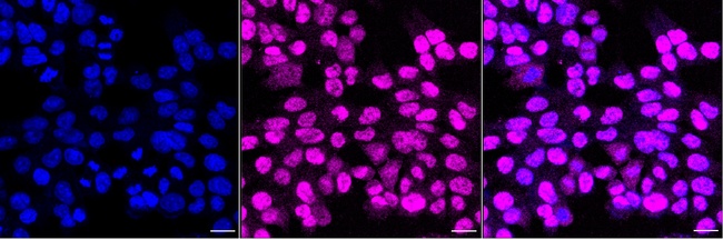 FTO Antibody in Immunocytochemistry (ICC/IF)