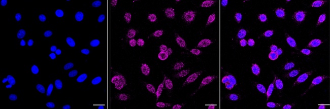 FTO Antibody in Immunocytochemistry (ICC/IF)