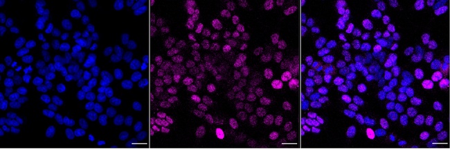 FOXP1 Antibody in Immunocytochemistry (ICC/IF)