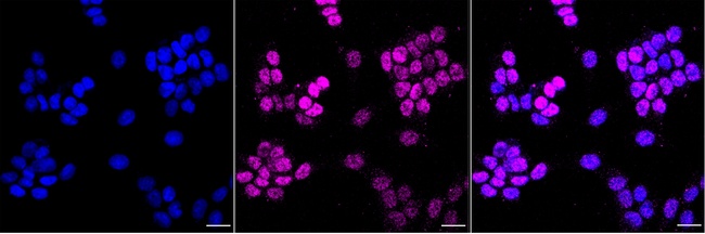 FOXP1 Antibody in Immunocytochemistry (ICC/IF)