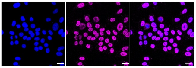 FOXA1 Antibody in Immunocytochemistry (ICC/IF)