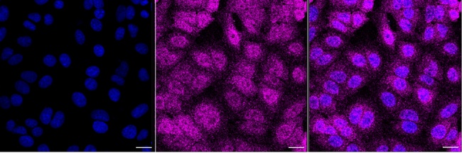 FNTA Antibody in Immunocytochemistry (ICC/IF)