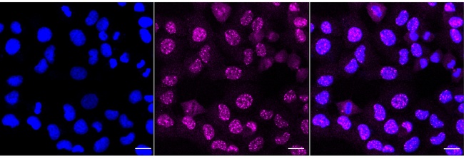 FLI1 Antibody in Immunocytochemistry (ICC/IF)