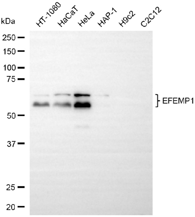 Fibulin 3 Antibody in Western Blot (WB)