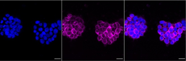 FDFT1 Antibody in Immunocytochemistry (ICC/IF)