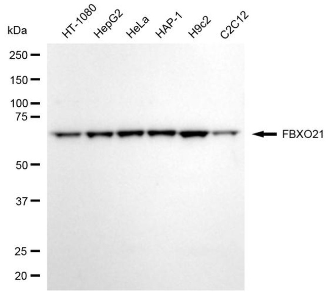 FBXO21 Antibody in Western Blot (WB)