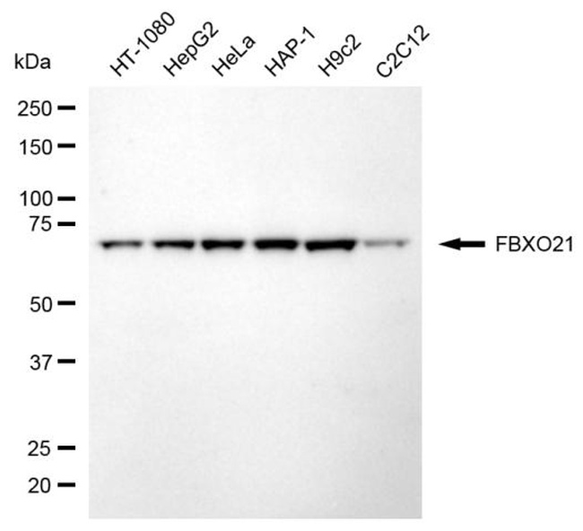 FBXO21 Antibody in Western Blot (WB)