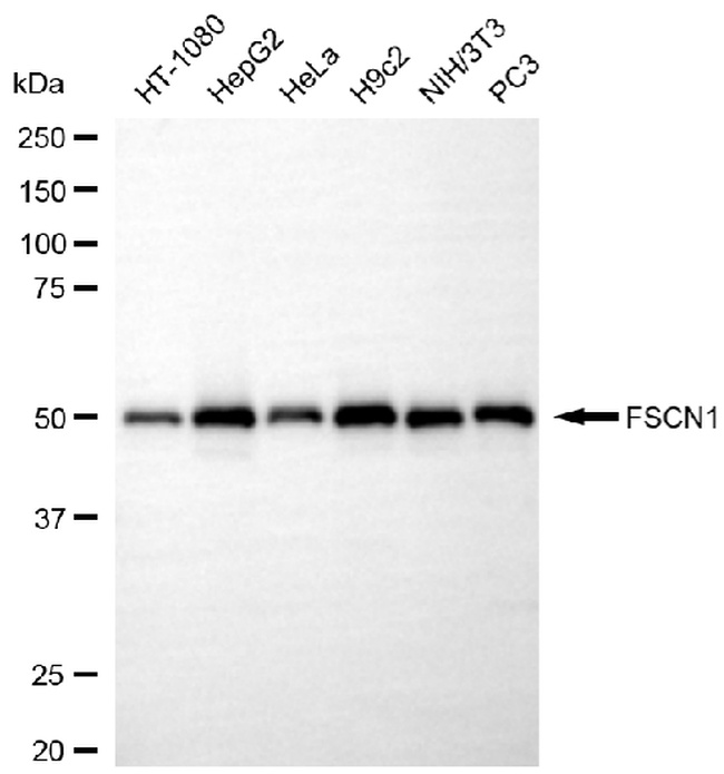 Fascin Antibody in Western Blot (WB)