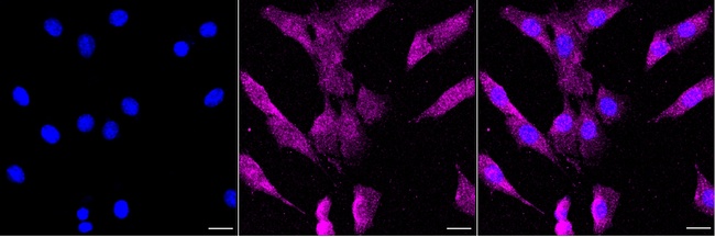 FAK Antibody in Immunocytochemistry (ICC/IF)