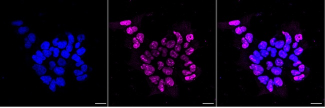 EZH2 Antibody in Immunocytochemistry (ICC/IF)