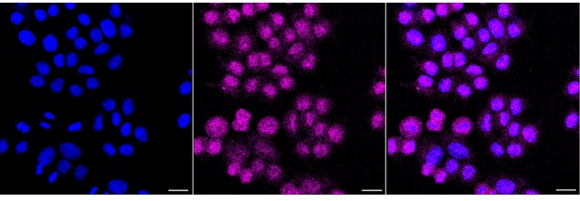 EXOSC7 Antibody in Immunocytochemistry (ICC/IF)