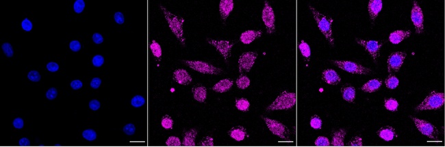 EXOC2 Antibody in Immunocytochemistry (ICC/IF)