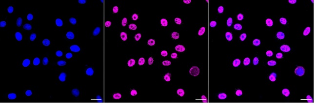 EWSR1 Antibody in Immunocytochemistry (ICC/IF)