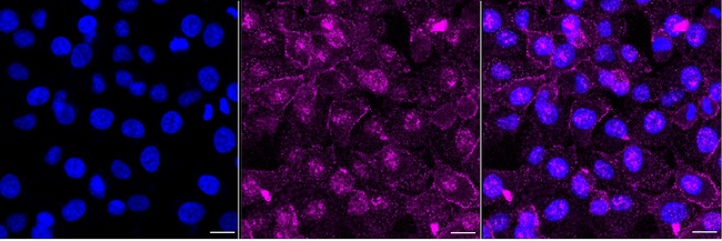 Epsin 1 Antibody in Immunocytochemistry (ICC/IF)