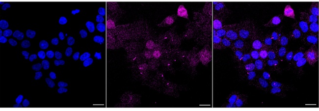 Epsin 2 Antibody in Immunocytochemistry (ICC/IF)
