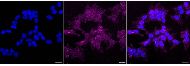 Epsin 2 Antibody in Immunocytochemistry (ICC/IF)