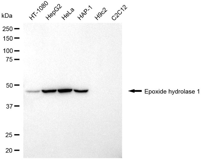 EPHX1 Antibody in Western Blot (WB)